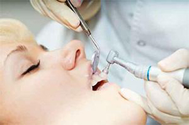 Irvine Preventative Dentist | teeth cleaning | Roya Toomarian DDS